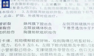 男子好心让同事“搭便车”却出车祸，被索赔十几万元，法院判决：“好意同乘”，酌情轻判